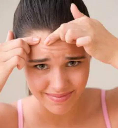 guide to Get rid of Acne スクリーンショット 0